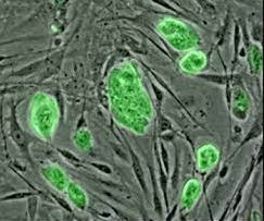 【朗報】ただの風邪で獲得したT細胞が新コロ感染を防ぐことが判明