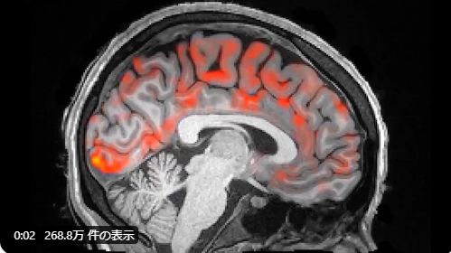 睡眠中に脳が脳脊髄液によって「洗浄」される動画