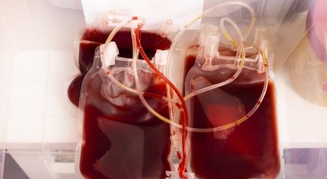 未接種者の血液の需要が激増、接種者から輸血を受けた人に異常な血栓が見つかる